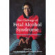 The Challenge of Fetal Alcohol Syndrome: Overcoming Secondary Disabilities