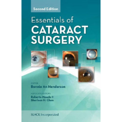 Essentials of Cataract Surgery