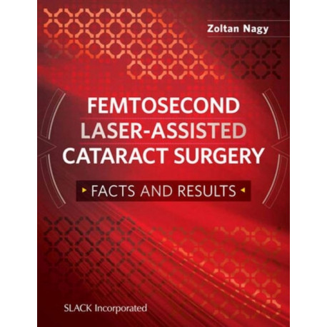 Femtosecond Laser-Assisted Cataract Surgery: Facts and Results