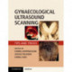 Gynaecological Ultrasound Scanning: Tips and Tricks