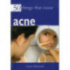 50 Things That Cause Acne