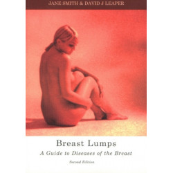 Breast Lumps: A guide to diseases of the breast