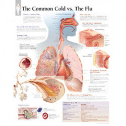 Understanding the Common Cold Laminated Poster