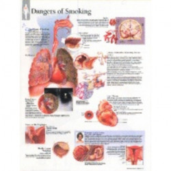 Effects of Smoking Laminated Poster