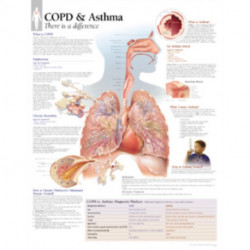 COPD & Asthma Laminated Poster