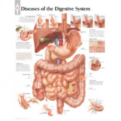 Diseases of the Digestive System Laminated Poster