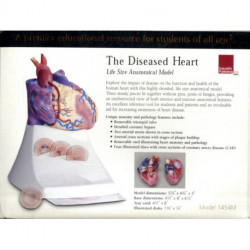Life Size Diseased Heart Model
