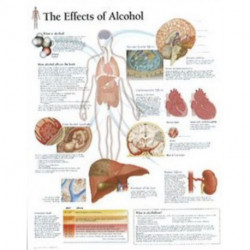 Effects of Alcohol Laminated Poster