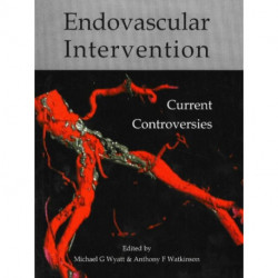 Endovascular intervention: Current controversies