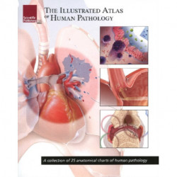 Illustrated Atlas of Human Pathology: A Collection of 25 Anatomical Charts of Human Pathology
