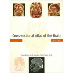 Cross-sectional Atlas of the Brain and DVD