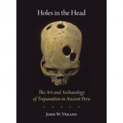 Holes in the Head: The Art and Archaeology of Trepanation in Ancient Peru