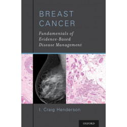 Breast Cancer: Fundamentals of Evidence-Based Disease Management