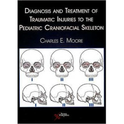 Diagnosis and Treatment of Traumatic Injuries to the Pediatric Craniofacial Skeleton