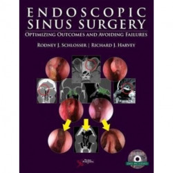 Endoscopic Sinus Surgery: Optimizing Outcomes and Avoiding Failures