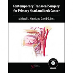 Contemporary Transoral Surgery for Primary Head and Neck Cancer
