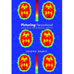 Picturing Personhood: Brain Scans and Biomedical Identity