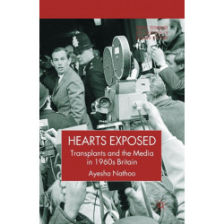 Hearts Exposed: Transplants and the Media in 1960s Britain