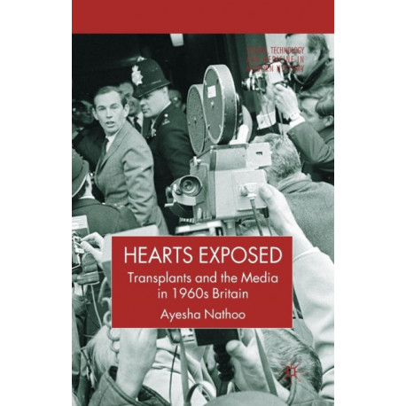 Hearts Exposed: Transplants and the Media in 1960s Britain