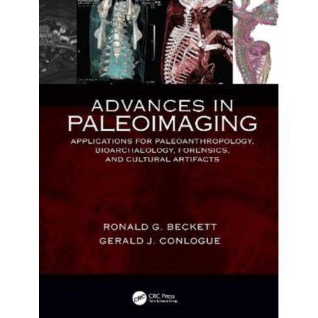 Advances in Paleoimaging: Applications for Paleoanthropology, Bioarchaeology, Forensics, and Cultural Artifacts