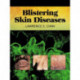 Blistering Skin Diseases