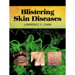 Blistering Skin Diseases
