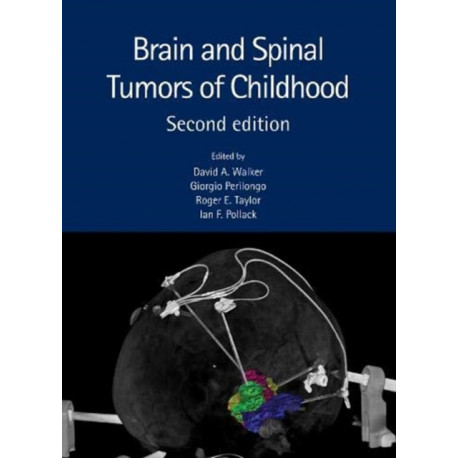 Brain and Spinal Tumors of Childhood