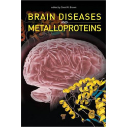 Brain Diseases and Metalloproteins