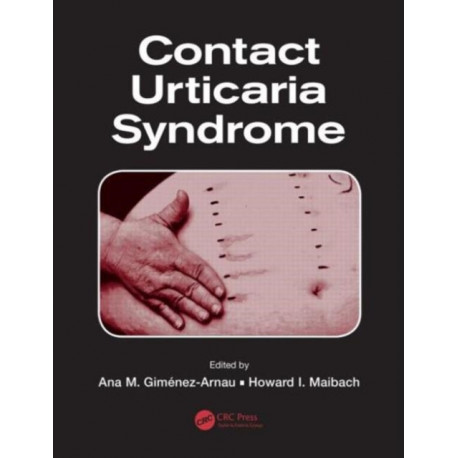 Contact Urticaria Syndrome