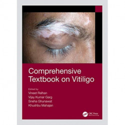 Comprehensive Textbook on Vitiligo