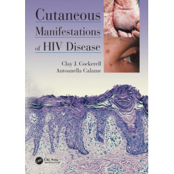 Cutaneous Manifestations of HIV Disease