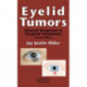 Eyelid Tumors