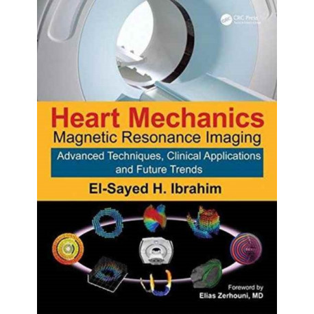 Heart Mechanics: Magnetic Resonance Imaging—Advanced Techniques, Clinical Applications, and Future Trends