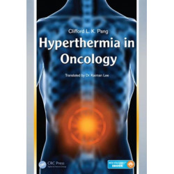 Hyperthermia in Oncology