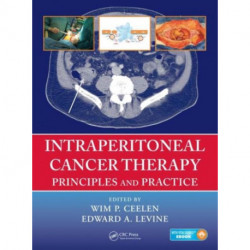 Intraperitoneal Cancer Therapy: Principles and Practice