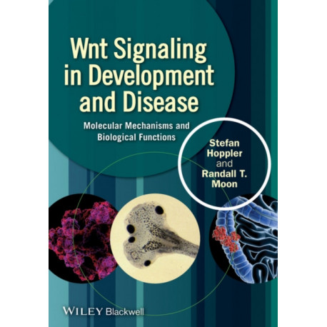 Wnt Signaling in Development and Disease: Molecular Mechanisms and Biological Functions