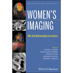 Women's Imaging: MRI with Multimodality Correlation