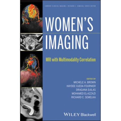 Women's Imaging: MRI with Multimodality Correlation