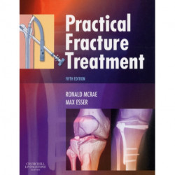 Practical Fracture Treatment