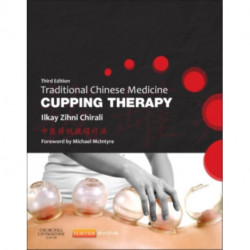 Traditional Chinese Medicine Cupping Therapy