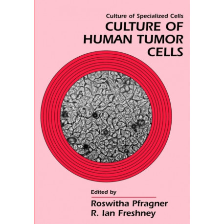 Culture of Human Tumor Cells