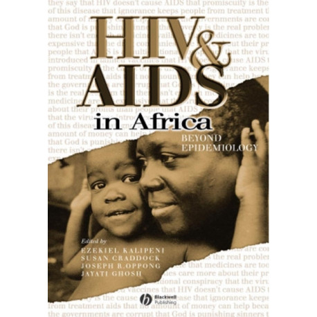 HIV and AIDS in Africa: Beyond Epidemiology