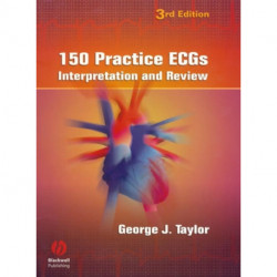 150 Practice ECGs: Interpretation and Review