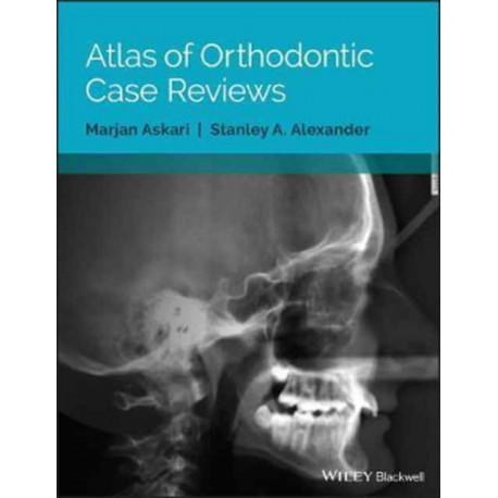 Atlas of Orthodontic Case Reviews