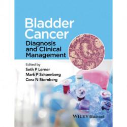 Bladder Cancer: Diagnosis and Clinical Management