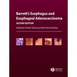 Barrett's Esophagus and Esophageal Adenocarcinoma