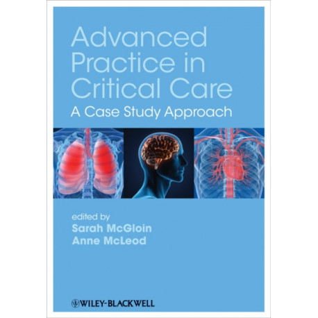 Advanced Practice in Critical Care: A Case Study Approach