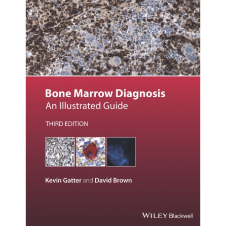 Bone Marrow Diagnosis: An Illustrated Guide