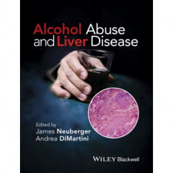 Alcohol Abuse and Liver Disease