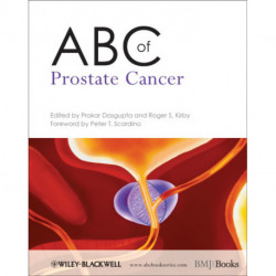ABC of Prostate Cancer